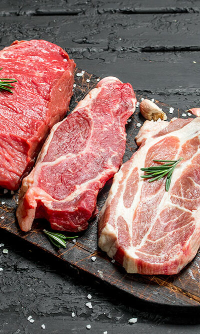 Prurigo nodularis – Foods to avoid, and management options